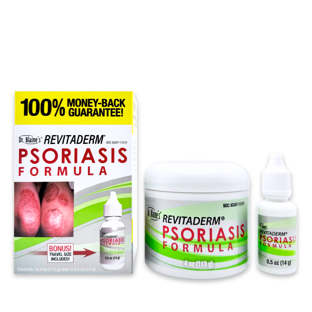 psoriasis
